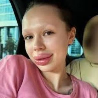 Шлв